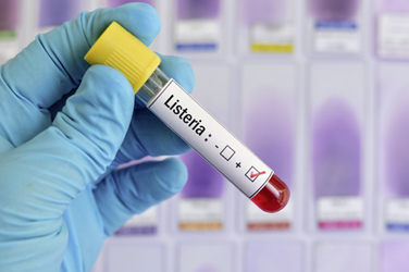 Ter Beke : le prix du porc nous inquiète plus que la listeria !